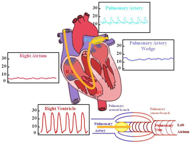 REACTIVE OXYGEN AND NITROGEN SPECIES IN PULMONARY HYPERTENSION PMC