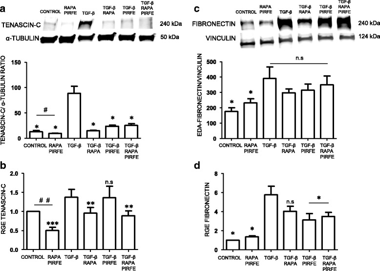 Anti Fibrotic Effects Of Pirfenidone And Rapamycin In Primary Ipf