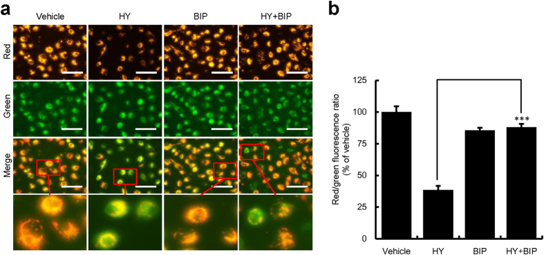 Hypericin Photodynamic Therapy Induces Human Umbilical Vein Endothelial