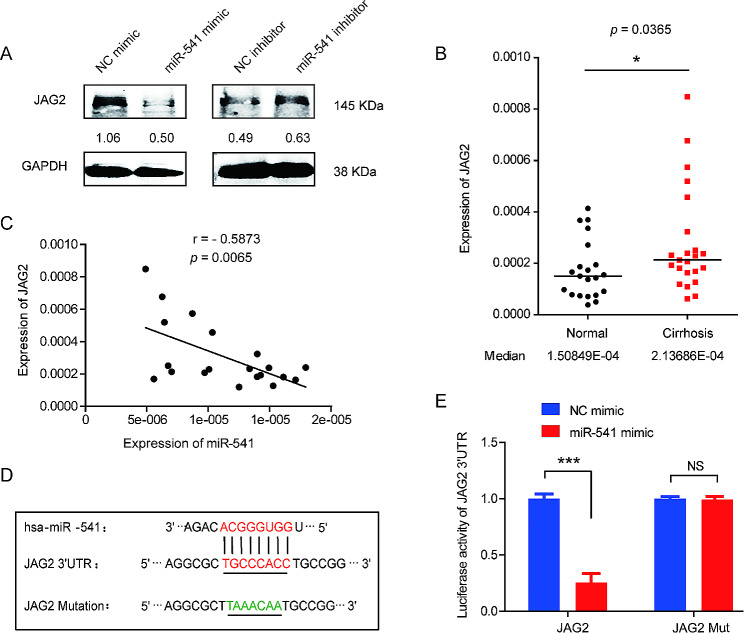 Mir Is Associated With The Prognosis Of Liver Cirrhosis And