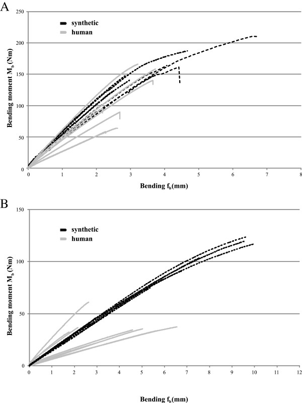 Stiffness And Ultimate Load Of Osseointegrated Prosthesis Fixations In