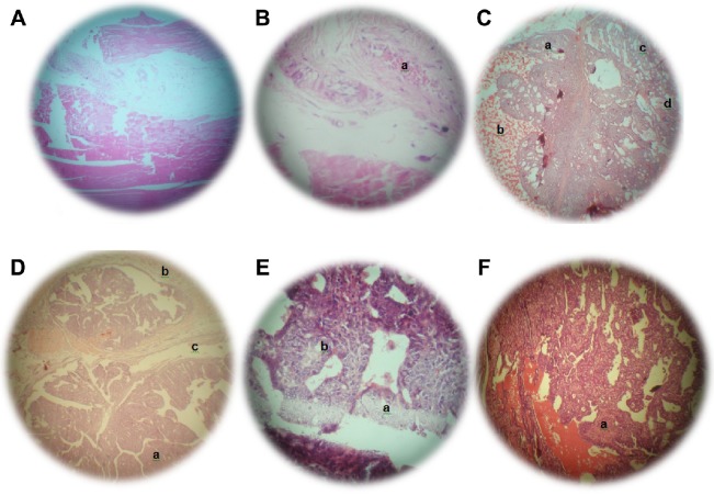 Protective Effect Of Piper Aduncum Capsule On Dmba Induced Breast