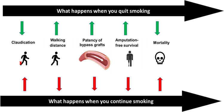 A Modern Day Perspective On Smoking In Peripheral Artery Disease PMC