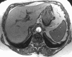 Figure 2a: