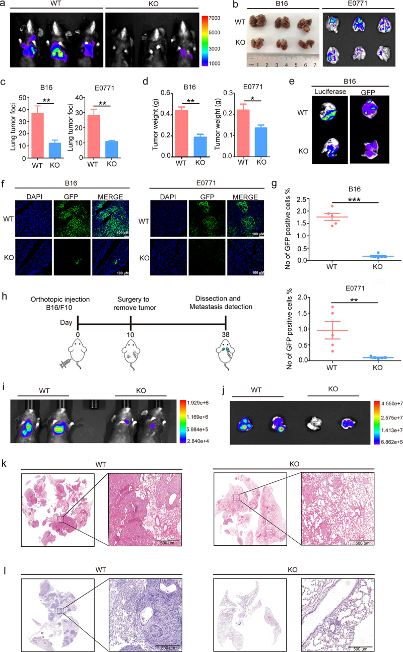 S100A10 Promotes Cancer Metastasis Via Recruitment Of MDSCs Within The