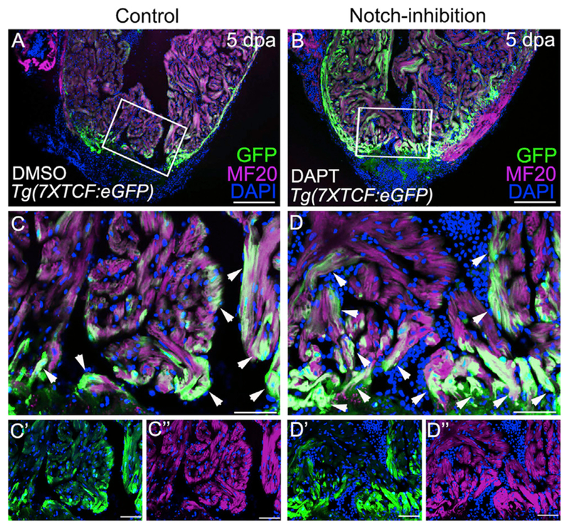 Endocardial Notch Signaling Promotes Cardiomyocyte Proliferation In The