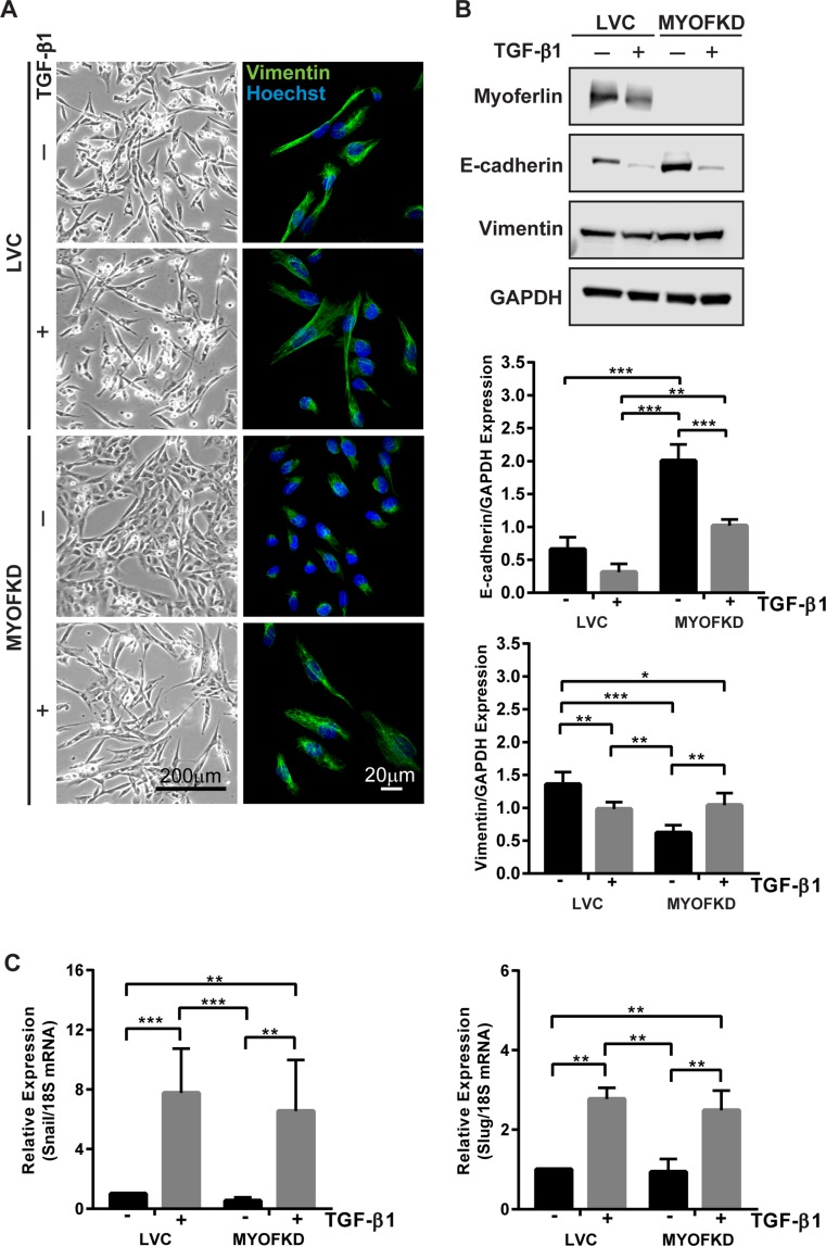 Myoferlin Regulates Epithelial Cancer Cell Plasticity And Migration