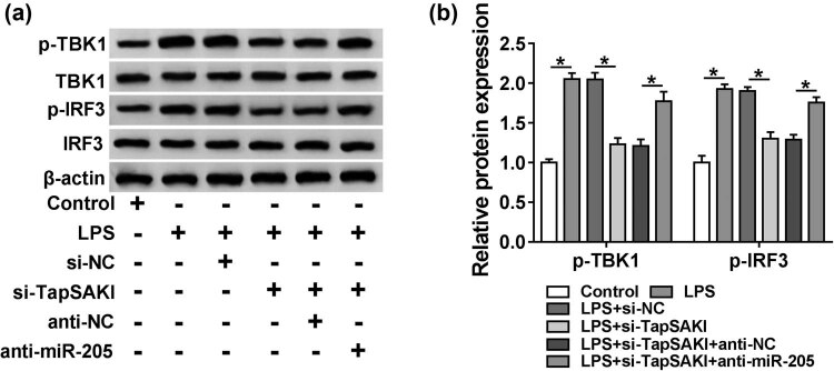 Knockdown Of Lncrna Tapsaki Alleviates Lps Induced Injury In Hk Cells