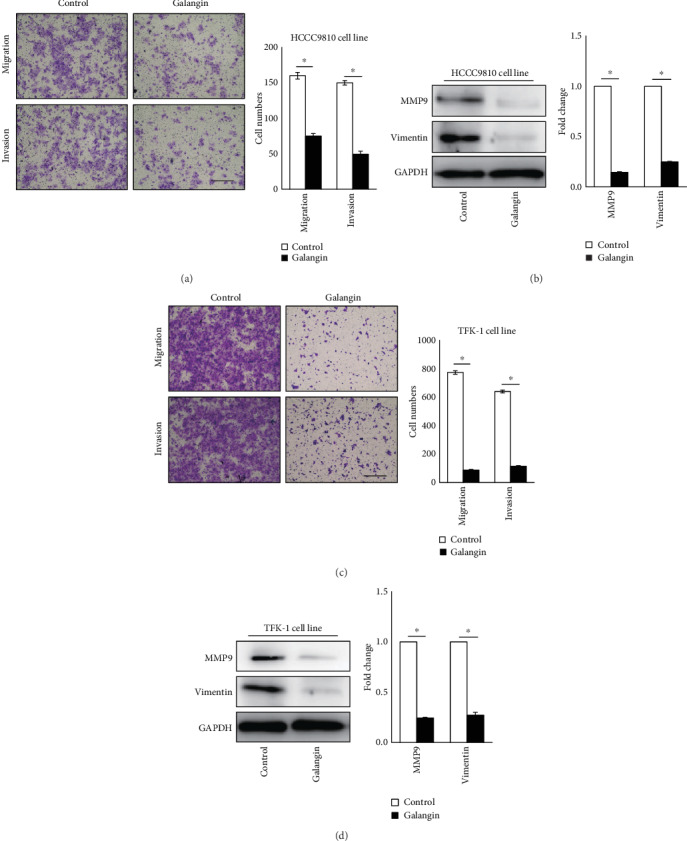 Galangin Inhibits Cholangiocarcinoma Cell Growth And Metastasis Through