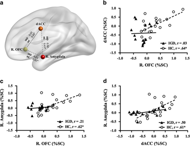 Dysfunction Of The Frontolimbic Region During Swear Word Processing In