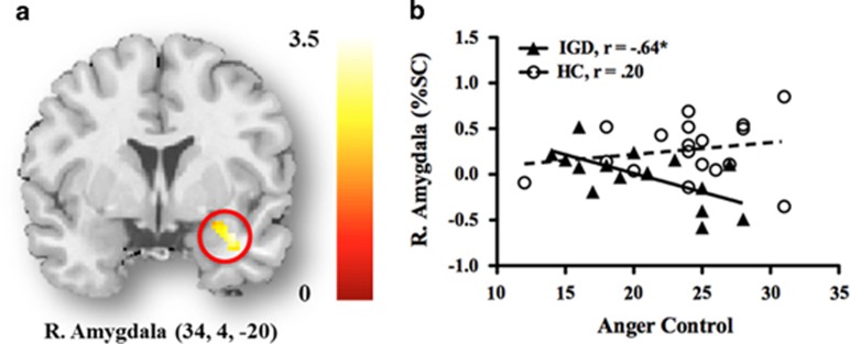 Dysfunction Of The Frontolimbic Region During Swear Word Processing In