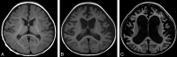 Fig 5.