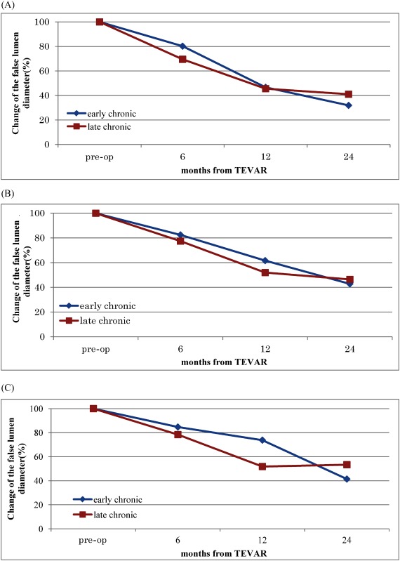 Endovascular Therapy For Chronic Type B Aortic Dissection PMC