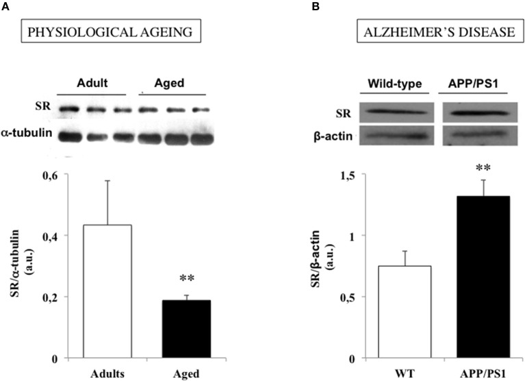 Changes In Serine Racemase Dependent Modulation Of Nmda Receptor