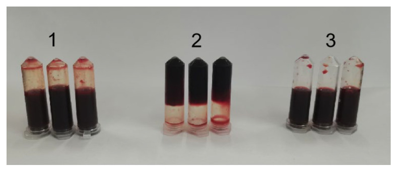 Purification And Biochemical Characterization Of A Novel Fibrinolytic