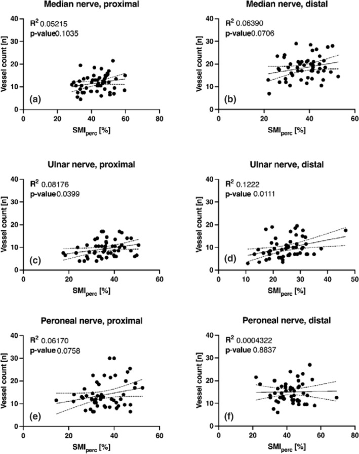 Intraneural Vascularity Of The Median Ulnar And Common Peroneal Nerve