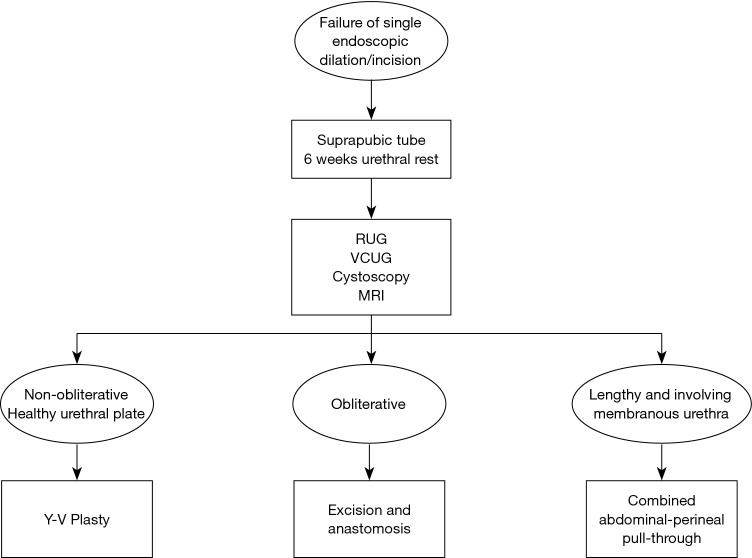 Robotic Urethral Reconstruction Redefining The Paradigm Of Posterior