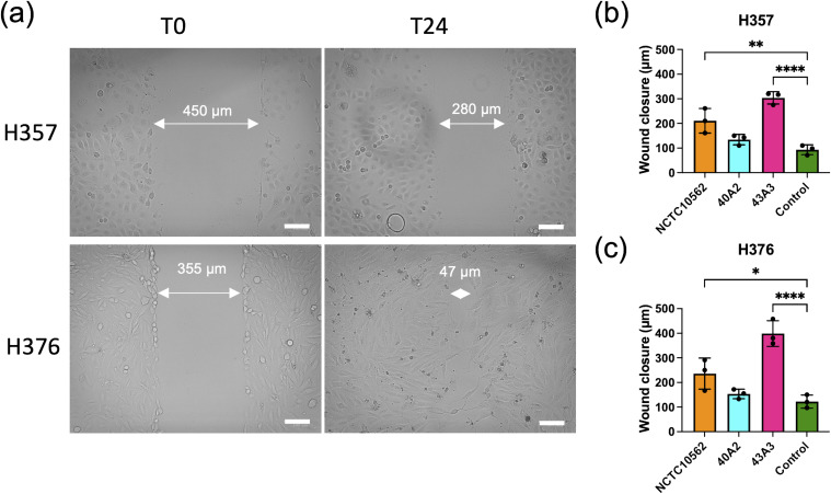 Fusobacterium Nucleatum Induces Invasive Growth And Angiogenic