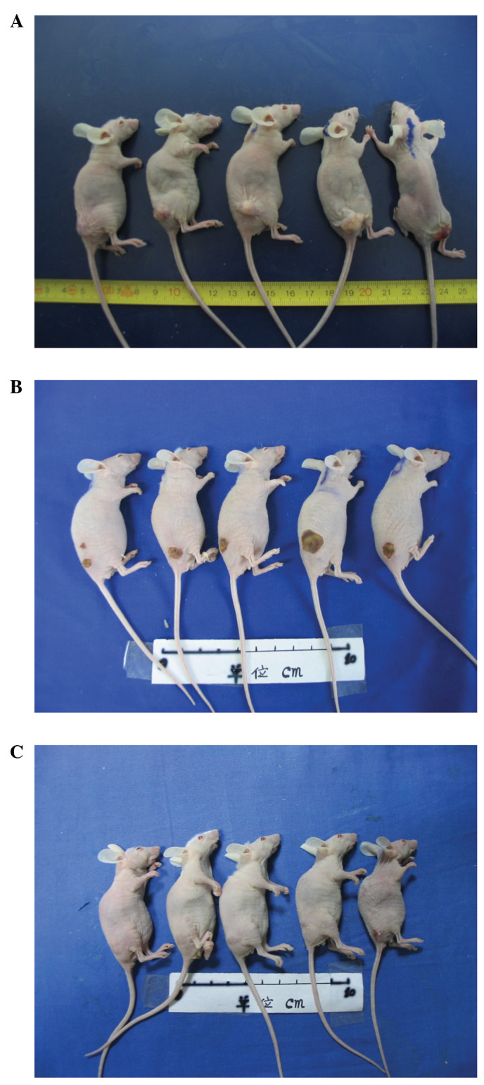 Treatment Of Pancreatic Cancer In A Nude Mouse Model Using High