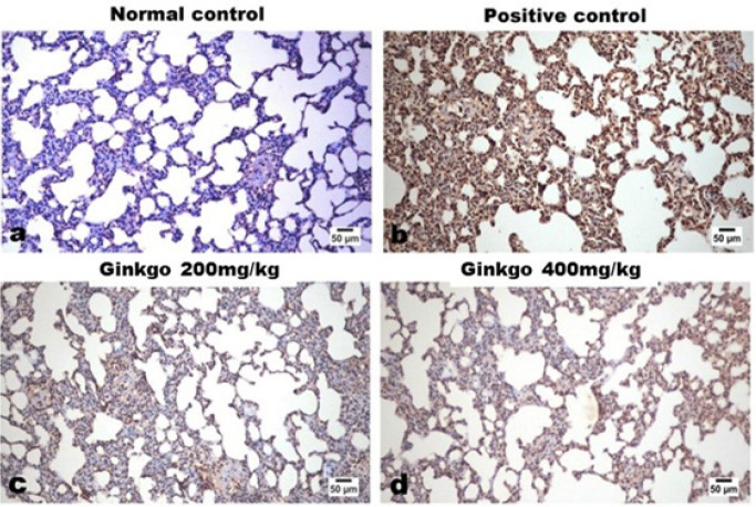 L Arginine Induced Acute Pancreatitis And Its Associated Lung Injury In