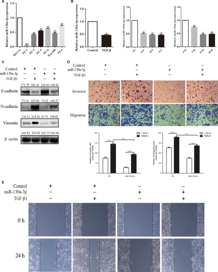 Mir A P Regulated Tgf Induced Epithelialmesenchymal Transition