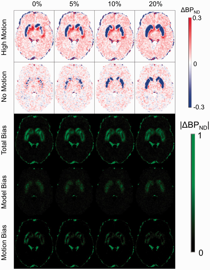 Assessment Of Motion And Model Bias On The Detection Of Dopamine