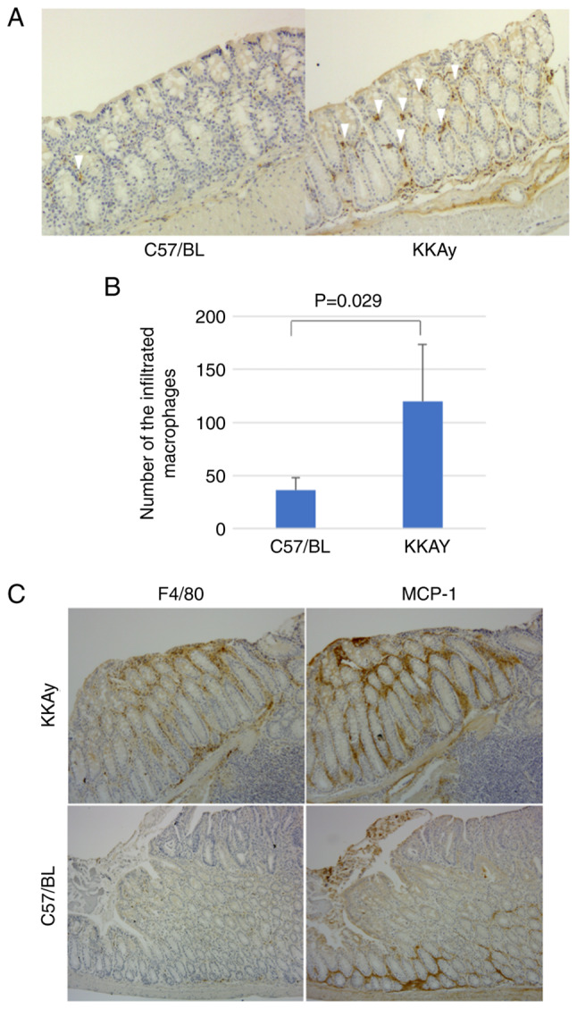 Role Of EphB2 Ephrin B1 Signalling In The Development And Progression