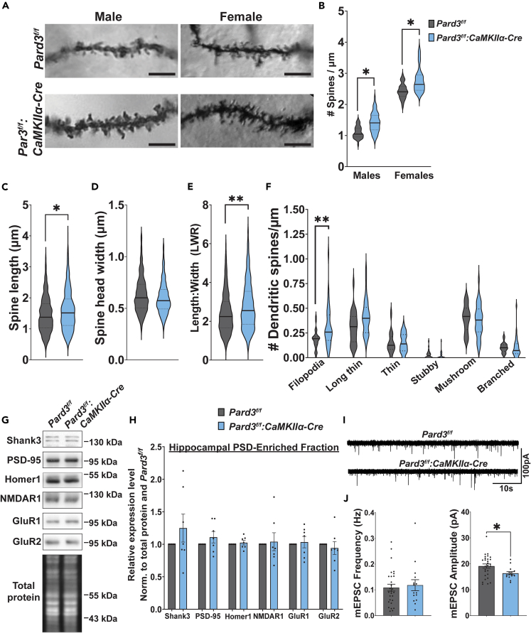 Loss Of The Polarity Protein Par Promotes Dendritic Spine Neoteny And