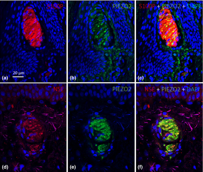 Sensory Innervation Of The Human Male Prepuce Meissner S Corpuscles