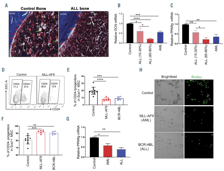 Exosome Driven Lipolysis And Bone Marrow Niche Remodeling Support