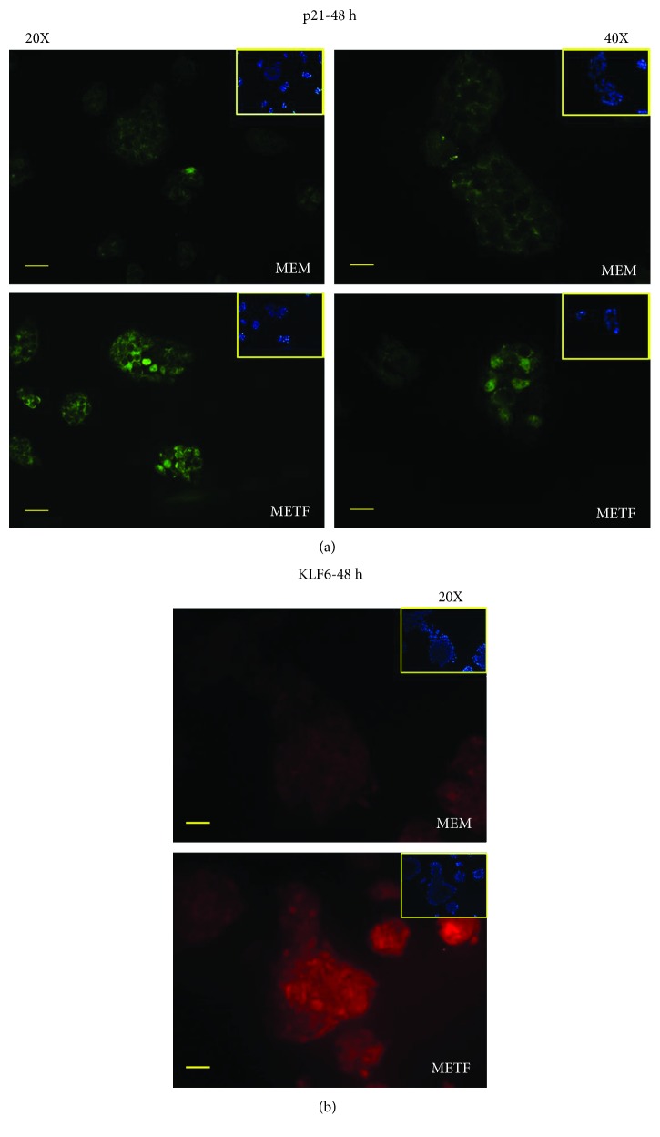 Metformin Counteracts HCC Progression And Metastasis Enhancing KLF6 P21