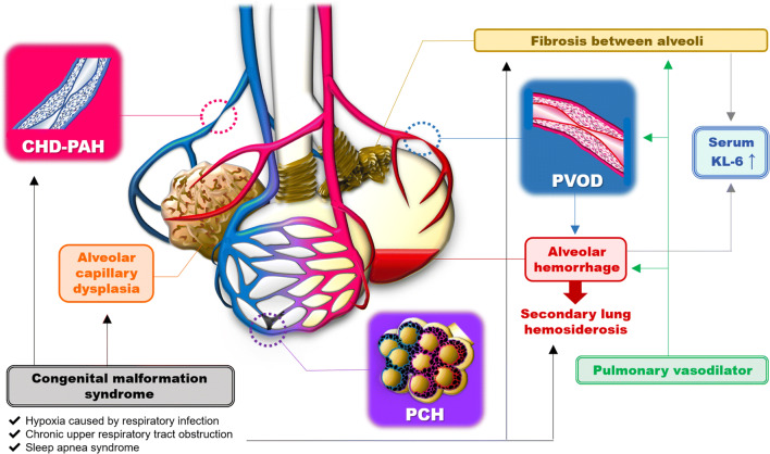 Pulmonary Vasodilators Can Lead To Various Complications In Pulmonary