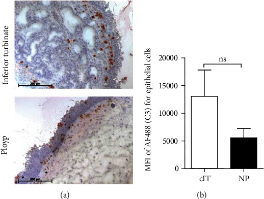 Linking Complement C3 And B Cells In Nasal Polyposis PMC