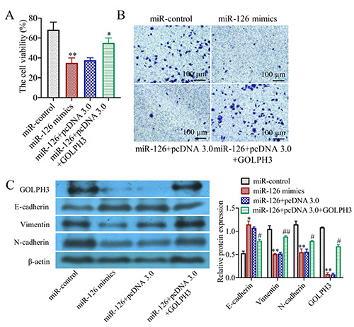 Mir Targeting Golph Inhibits The Epithelial Mesenchymal Transition