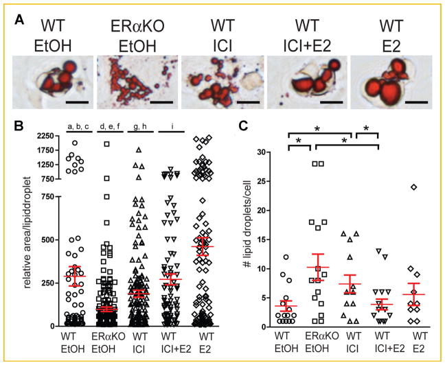 ERα Regulates Lipid Metabolism in Bone Through ATGL and Perilipin PMC