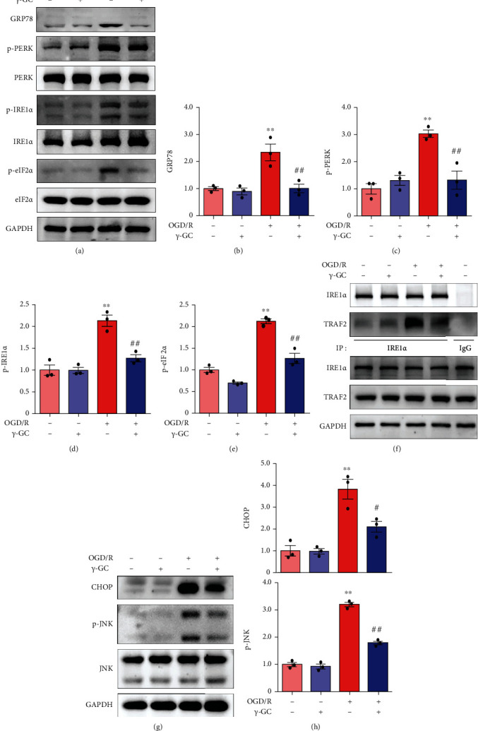 γ Glutamylcysteine Alleviates Ischemic Stroke Induced Neuronal