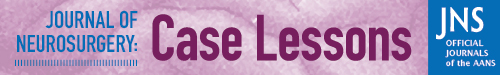 Journal of Neurosurgery: Case Lessons logo