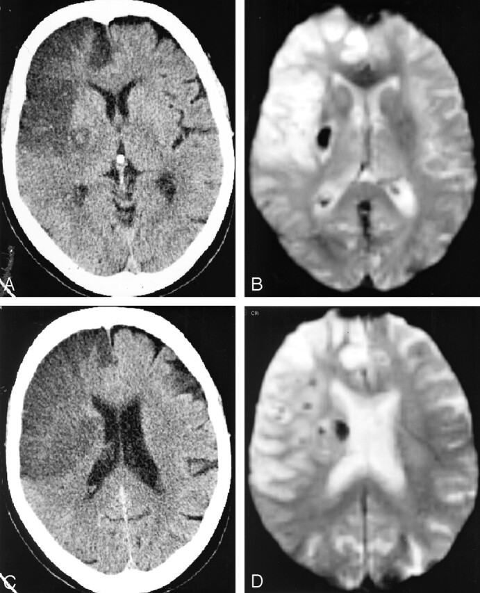 Fig 3.