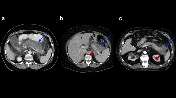 Fig. 2