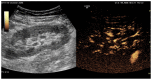 Figure 4a
