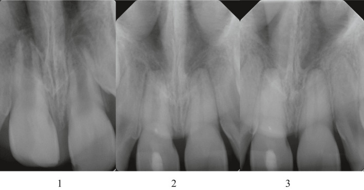 FIGURE 2