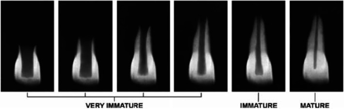 FIGURE 3