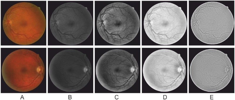 Fig 1