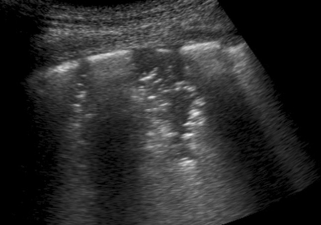 Fig. 4