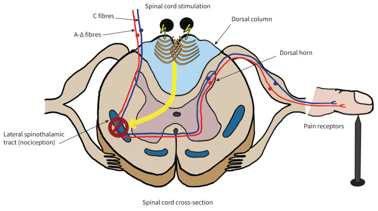 Figure 1: