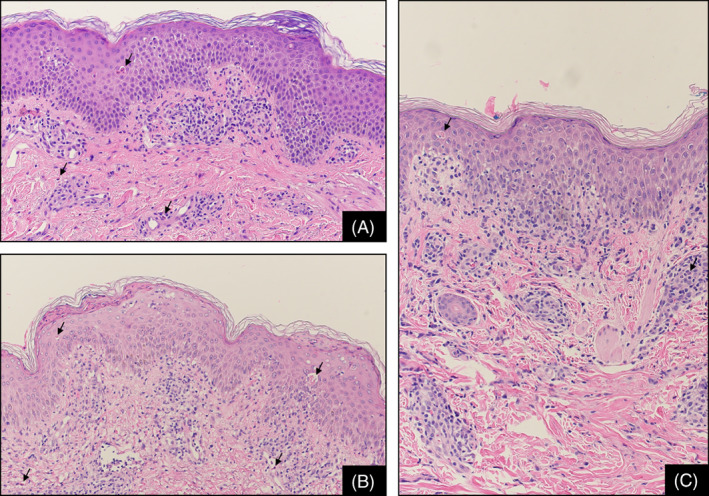 FIGURE 1