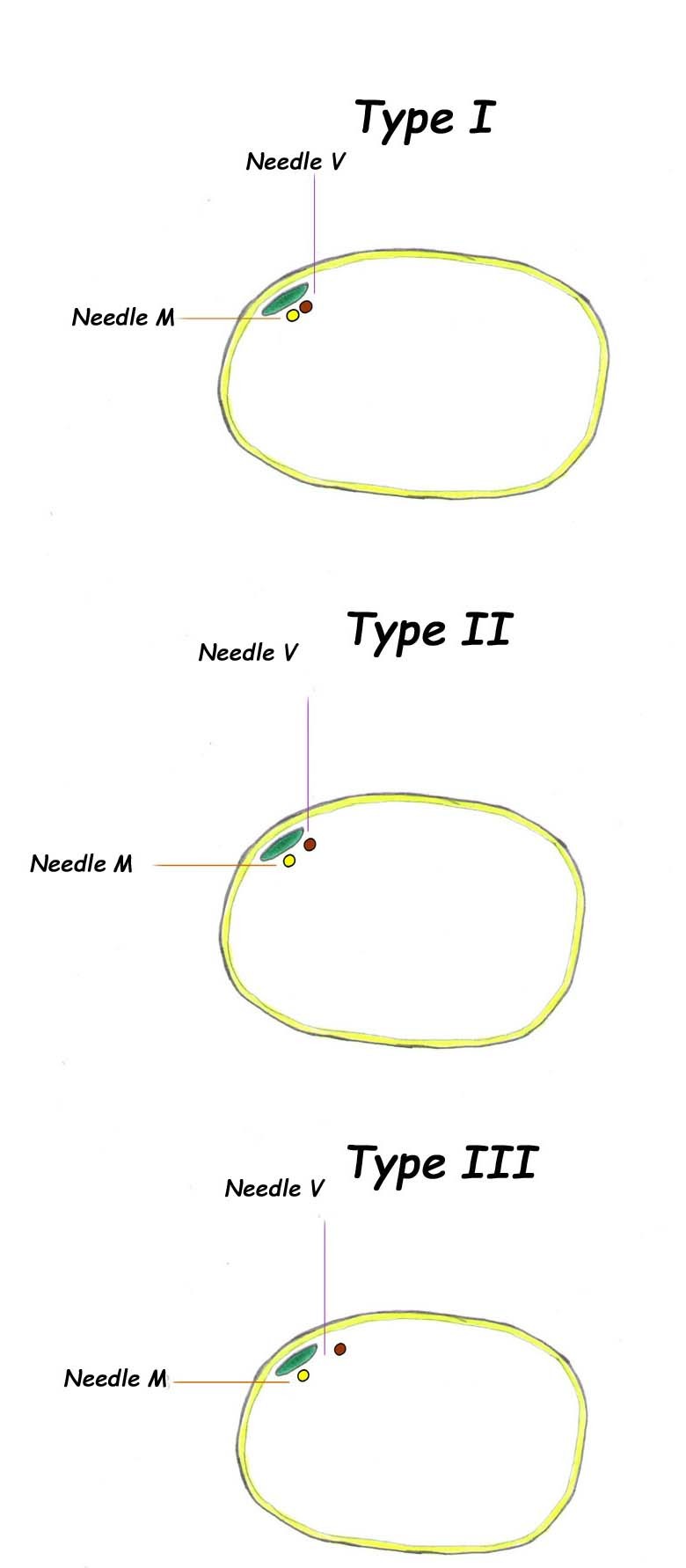 [Table/Fig-7]: