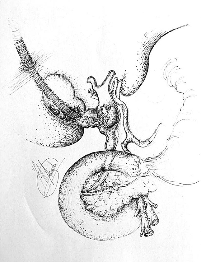 Fig. 2