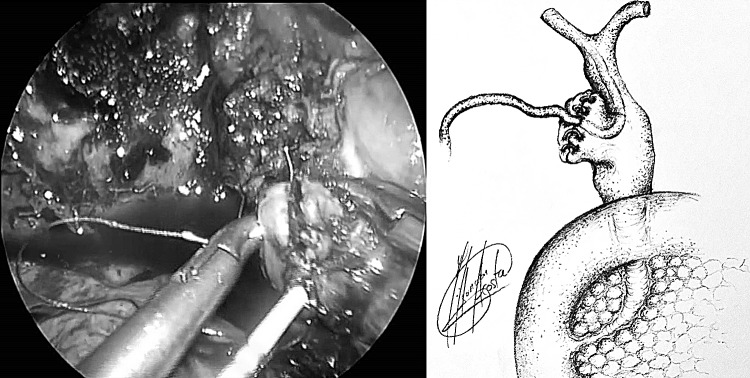 Fig. 5