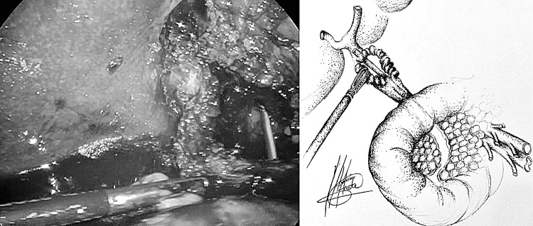 Fig. 4